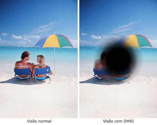 O que é DMRI e por que você deve conhecê-lo?